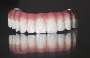 a full arch of dental implants with 2 implant holes