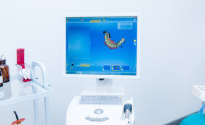 a digital smile design machine with a set of rendered teeth