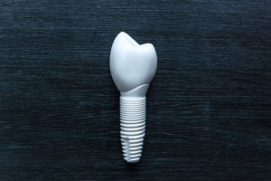 a dental implant made of non-metal for patients that have intolerances