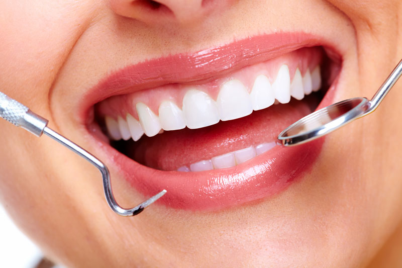 Close-up of a smiling mouth with white teeth being examined by dental tools, likely during a dental check-up or treatment.